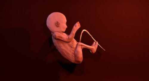 Fetus Human